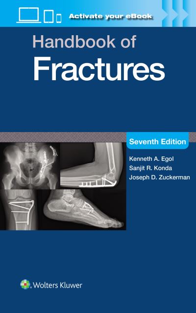 Rockwood and Green's Fractures in Adults - Dubray Books